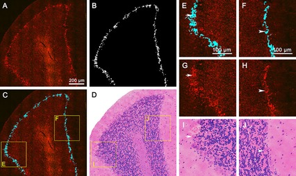 Rapid, label-free identification of cerebellar structures using multiphoton microscopy