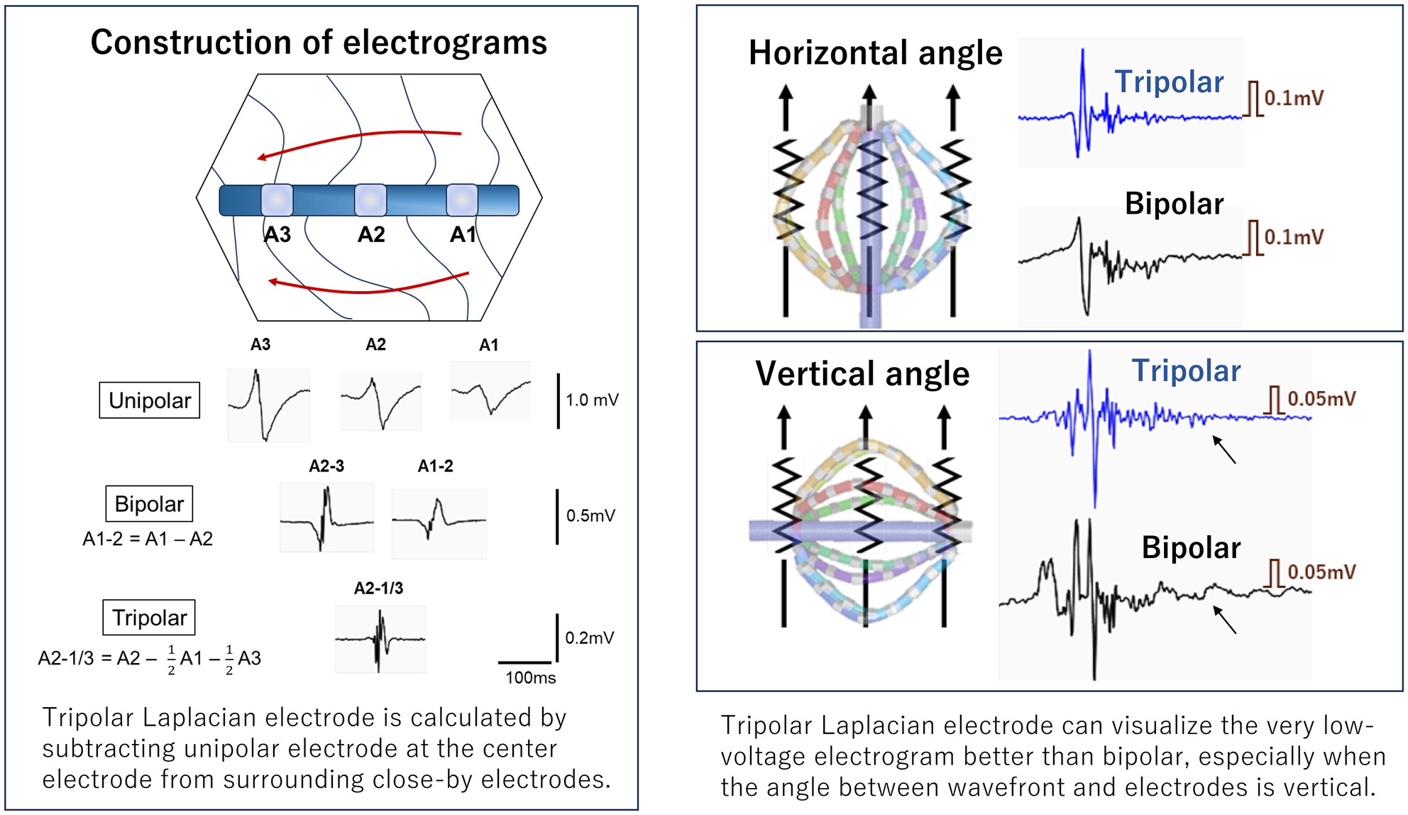 The signal quality of tripolar Laplacian electrogram compared to bipolar electrogram in cardiac electrophysiology