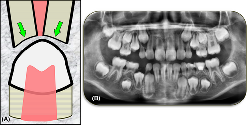 Details are in the caption following the image Details are in the caption following the image