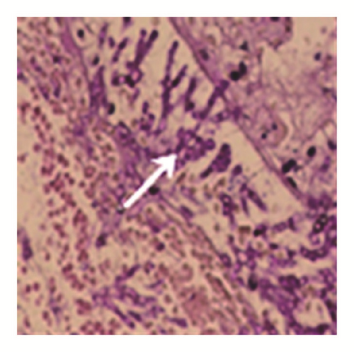 Details are in the caption following the image