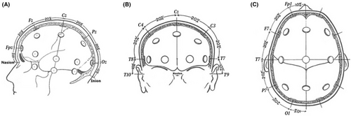 Details are in the caption following the image Details are in the caption following the image