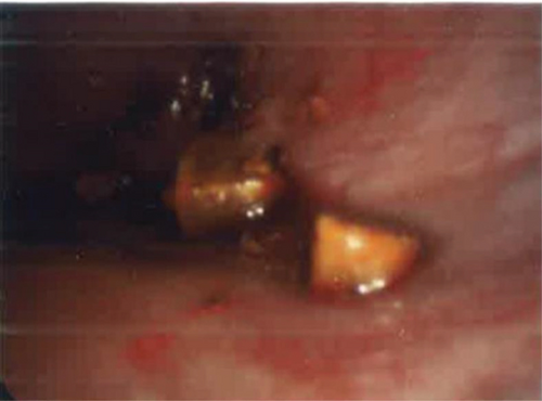 Details are in the caption following the image