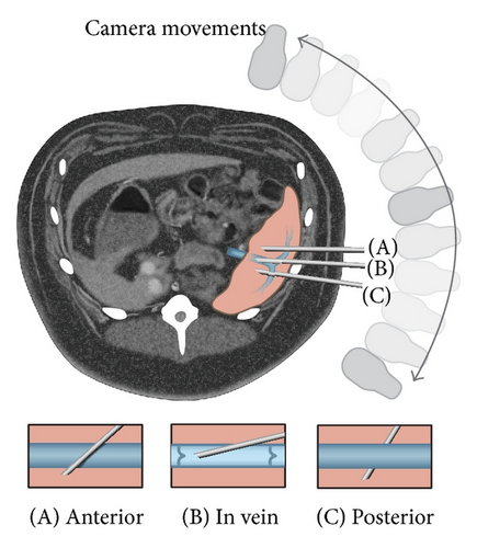 Details are in the caption following the image