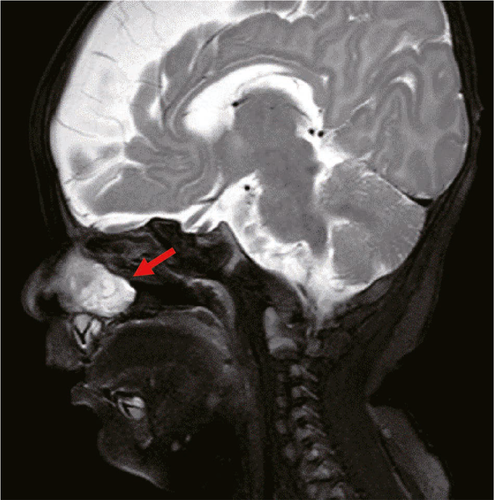 Details are in the caption following the image