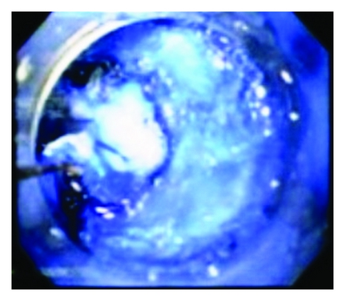 Details are in the caption following the image