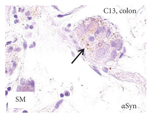 Details are in the caption following the image