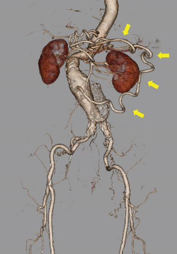 Details are in the caption following the image