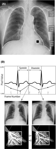 Details are in the caption following the image