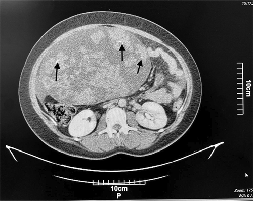 Details are in the caption following the image Details are in the caption following the image