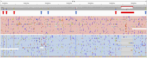 Evaluation of the detection of GBA missense mutations and other variants using the Oxford Nanopore MinION