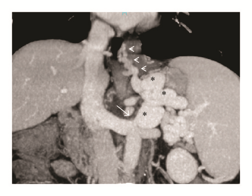 Details are in the caption following the image