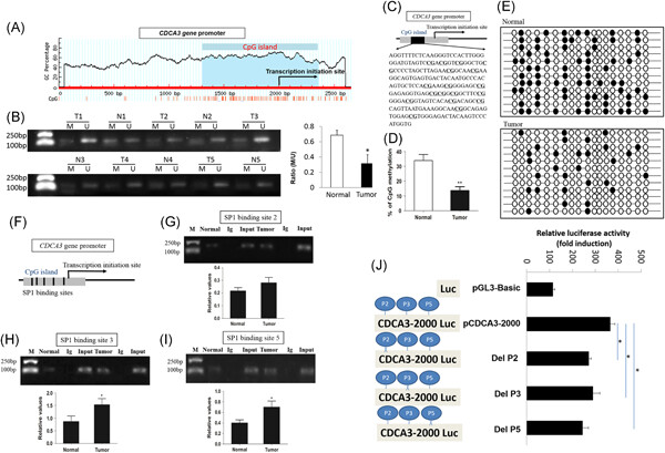 DNA hypomethylation promotes invasion and metastasis of gastric cancer cells by regulating the binding of SP1 to the CDCA3 promoter