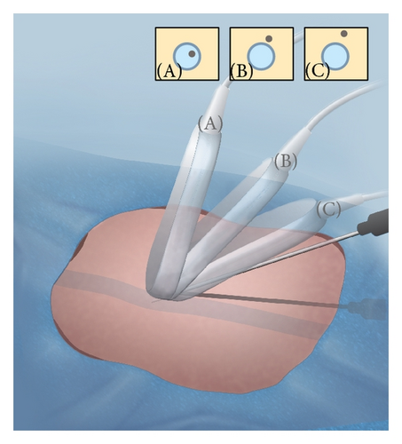 Details are in the caption following the image