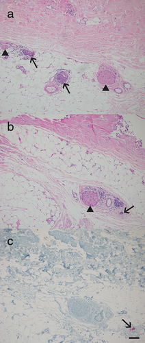 Details are in the caption following the image Details are in the caption following the image