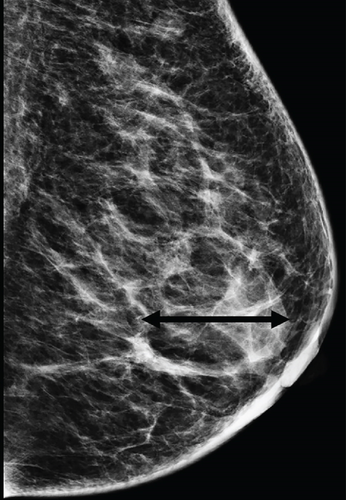 Details are in the caption following the image
