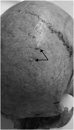 Details are in the caption following the image