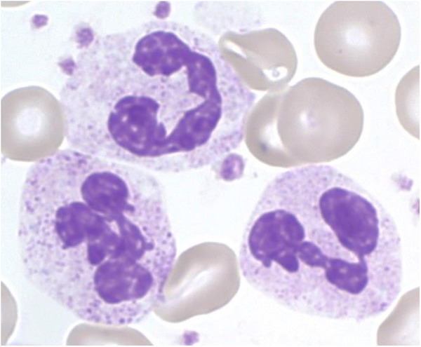 The influence of extracellular tissue on neutrophil function and its possible linkage to inflammatory diseases