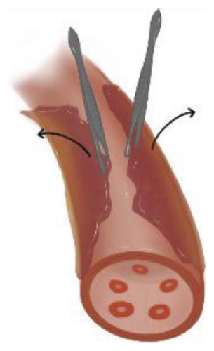 Details are in the caption following the image