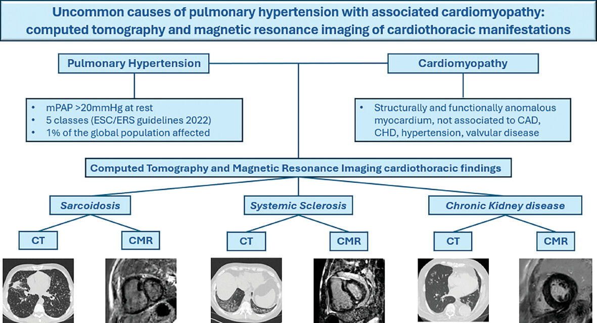 Uncommon Causes of Pulmonary Hypertension With Associated Cardiomyopathy: Computed Tomography and Magnetic Resonance Imaging of Cardiothoracic Manifestations
