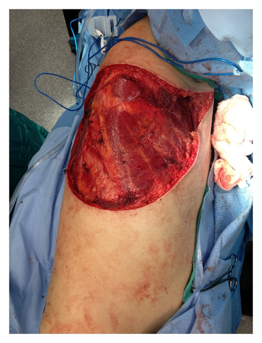Details are in the caption following the image Details are in the caption following the image