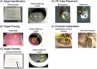 Binocular microscopes versus exoscopes: Experiences and performance in simulated otologic surgery