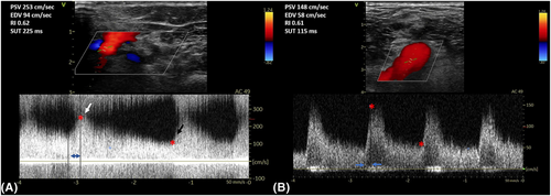 Details are in the caption following the image Details are in the caption following the image
