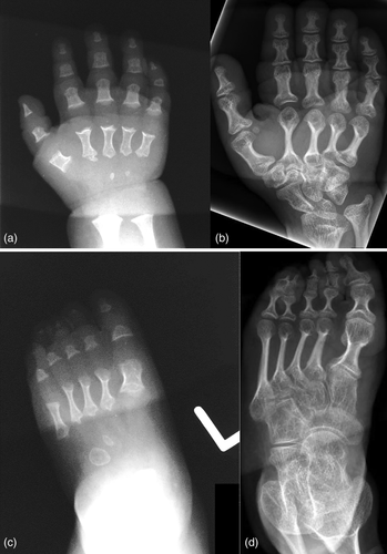 Details are in the caption following the image