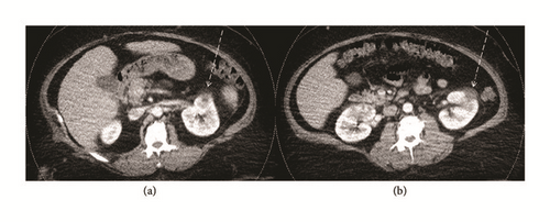 Details are in the caption following the image Details are in the caption following the image