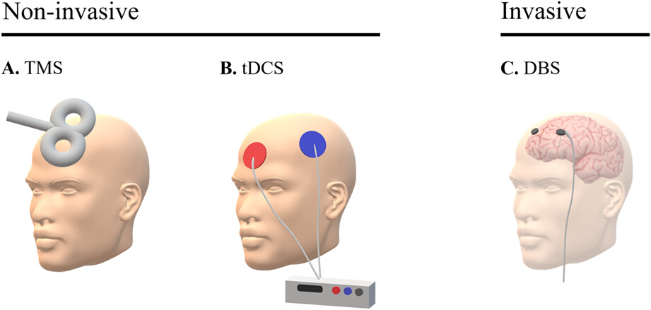 Therapeutic potential of brain stimulation techniques in the treatment of mental, psychiatric, and cognitive disorders