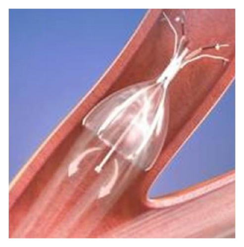 Details are in the caption following the image