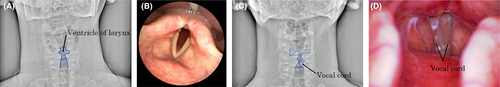 Details are in the caption following the image Details are in the caption following the image