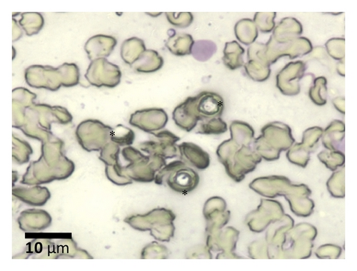 Details are in the caption following the image