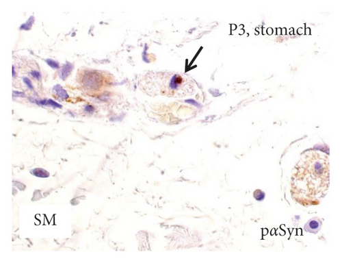 Details are in the caption following the image