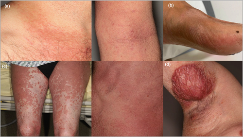 Details are in the caption following the image Details are in the caption following the image