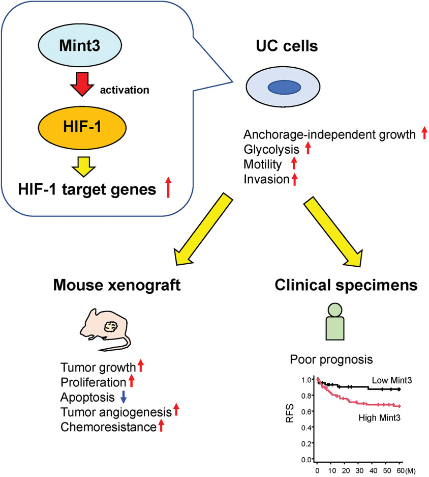 Hypoxia inducible factor-1 activator munc-18-interacting protein 3 promotes tumour progression in urothelial carcinoma