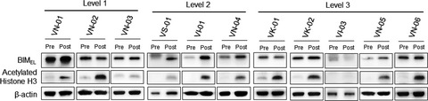 Phase I study of vorinostat with gefitinib in BIM deletion polymorphism/epidermal growth factor receptor mutation double-positive lung cancer