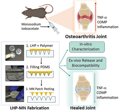 Polymeric Microneedles for Transdermal Delivery of Human Placental Tissue for the Treatment of Osteoarthritis