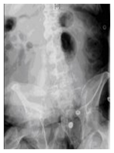 Details are in the caption following the image Details are in the caption following the image