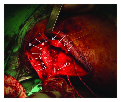 Details are in the caption following the image Details are in the caption following the image