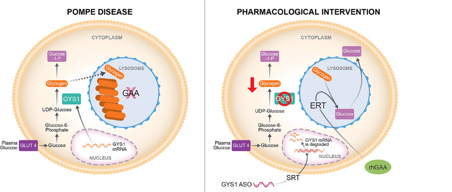 Skeletal muscle effects of antisense oligonucleotides targeting glycogen synthase 1 in a mouse model of Pompe disease