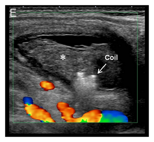 Details are in the caption following the image Details are in the caption following the image