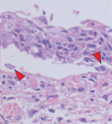 Details are in the caption following the image