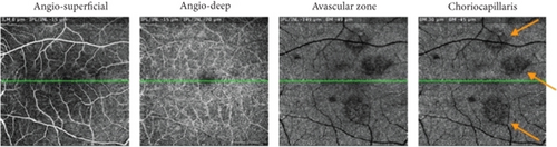 Details are in the caption following the image Details are in the caption following the image