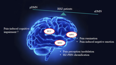 Disrupted default mode network dynamics in recuperative patients of herpes zoster pain
