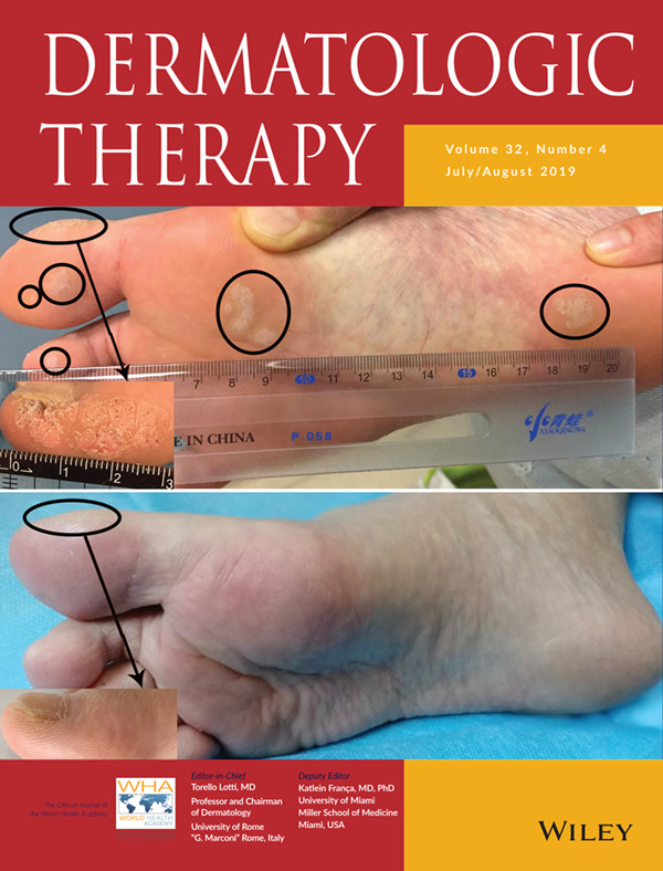 Cover Image, Volume 32 Issue 4