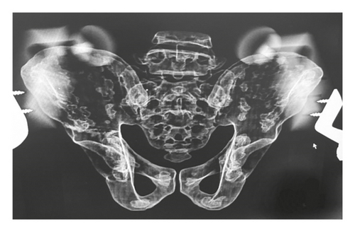 Details are in the caption following the image
