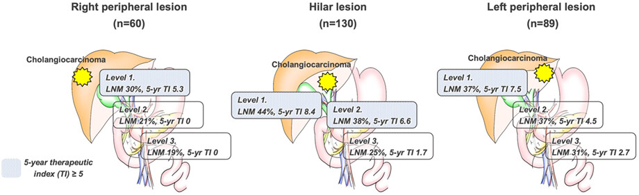 Clinical implications and optimal extent of lymphadenectomy for intrahepatic cholangiocarcinoma: A multicenter analysis of the therapeutic index
