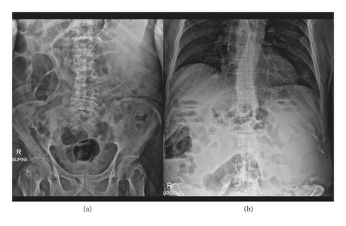 Details are in the caption following the image