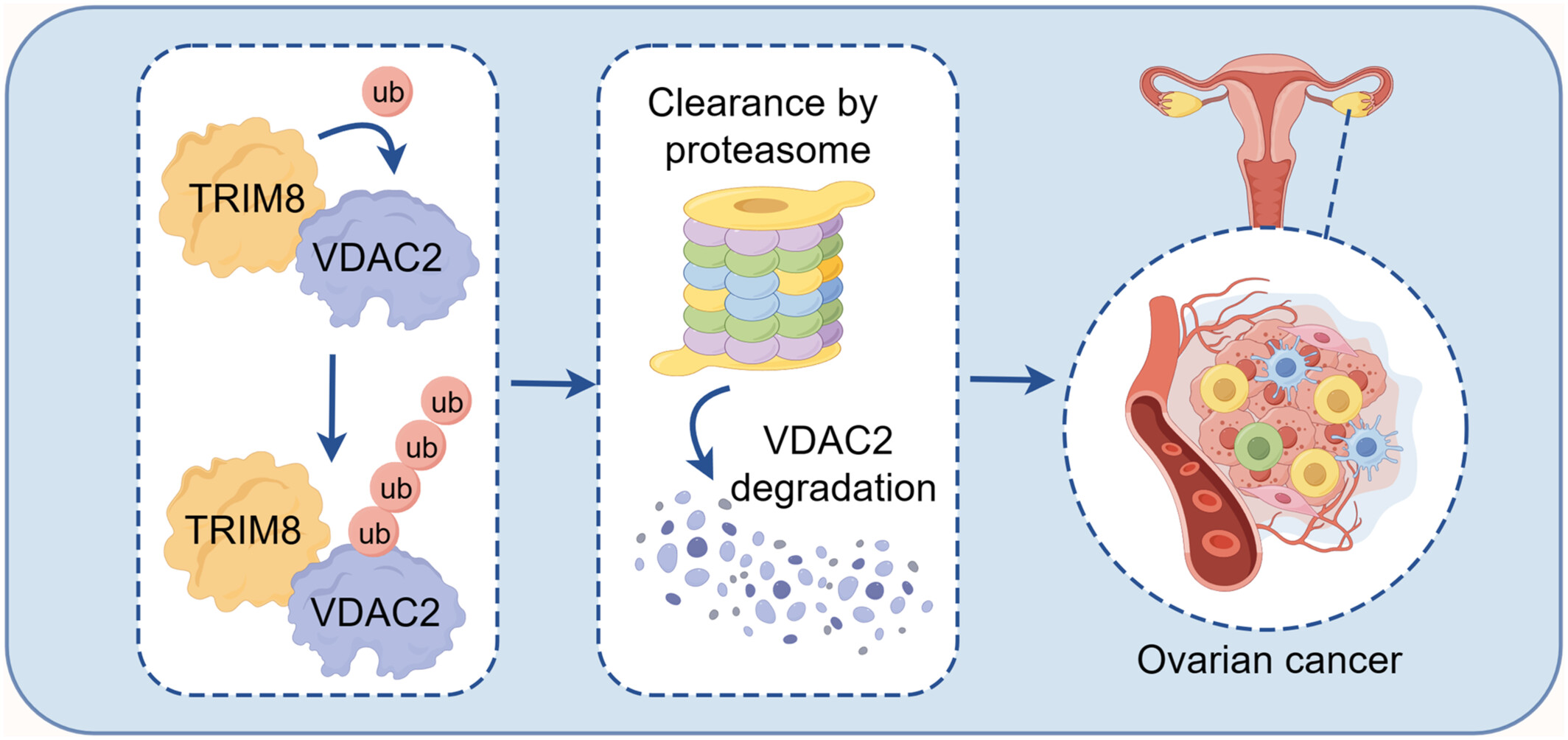TRIM8 promotes ovarian cancer proliferation and migration by targeting VDAC2 for ubiquitination and degradation