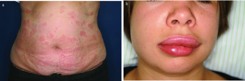 Details are in the caption following the image Details are in the caption following the image